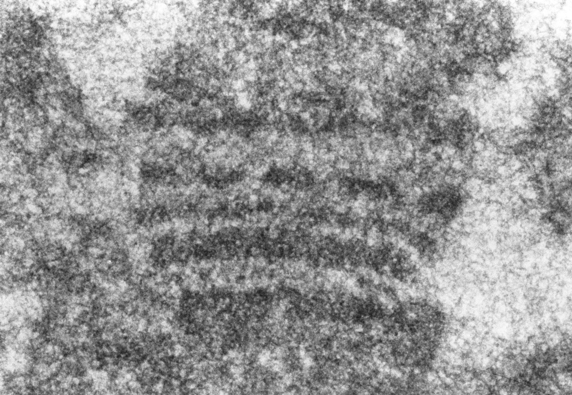 Drosophila Melanogaster Polytene Chromosome Cil Doccheck