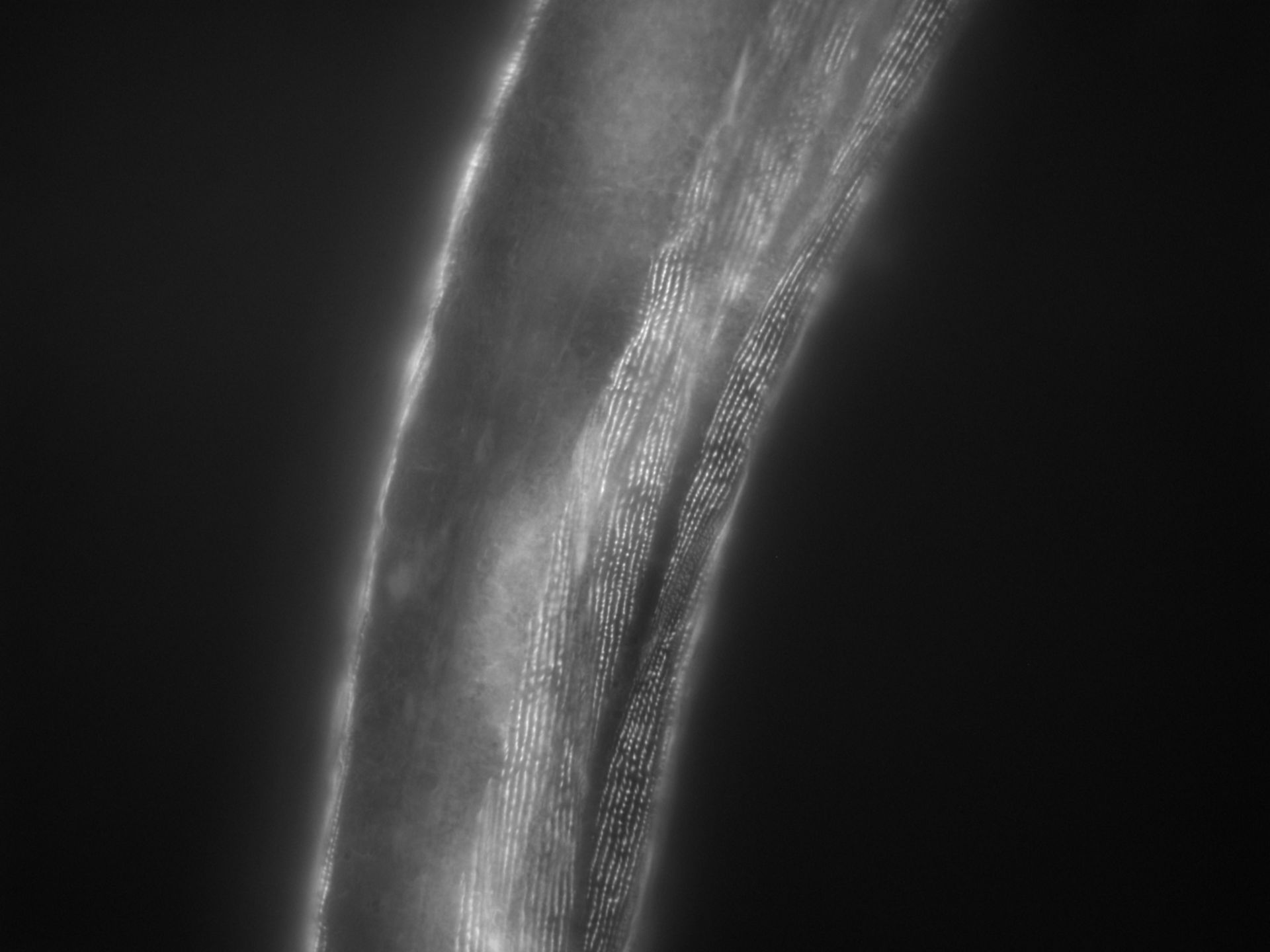 Caenorhabditis elegans (Actin filament) - CIL:1148