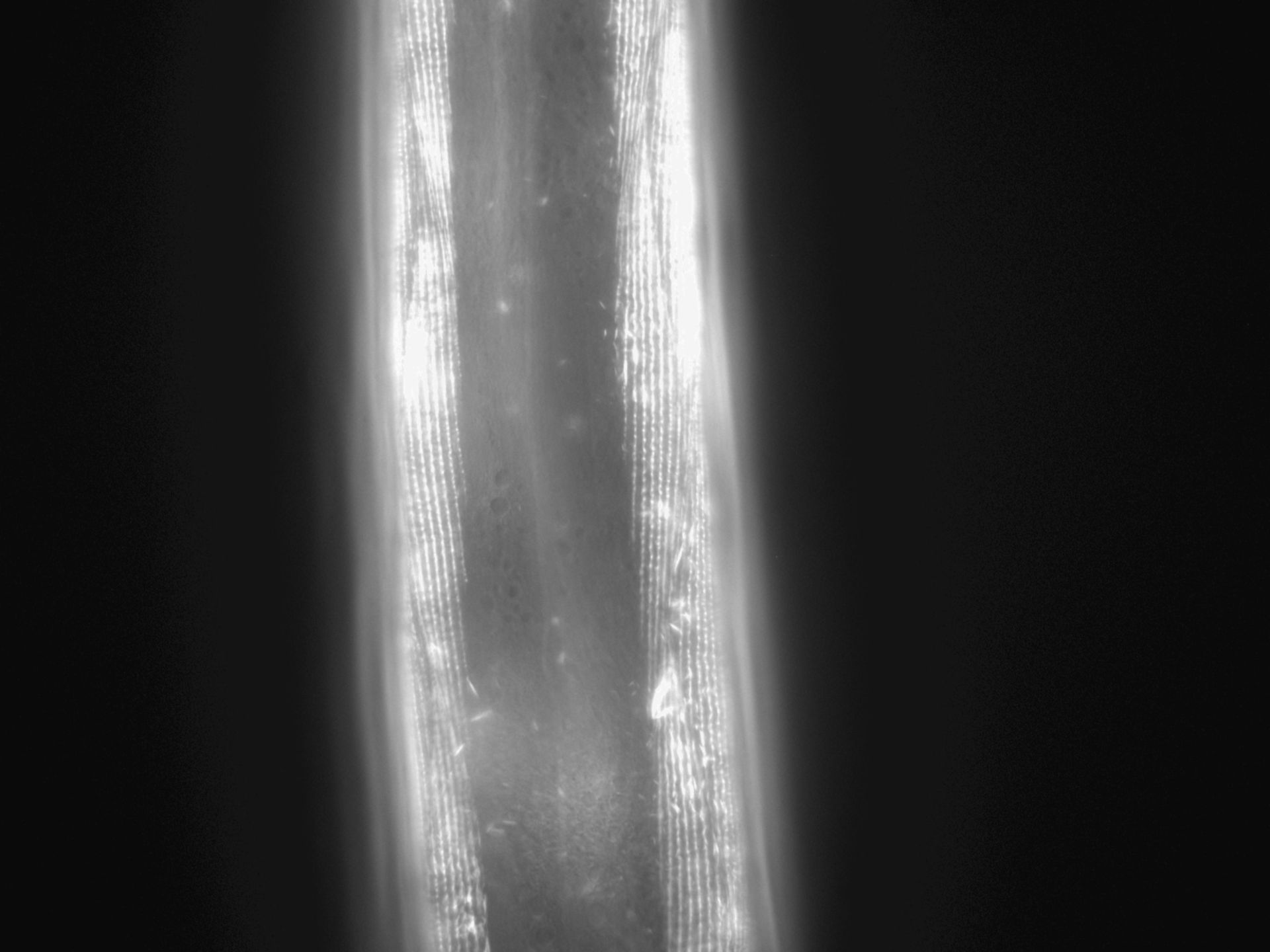 Caenorhabditis elegans (Actin filament) - CIL:1032