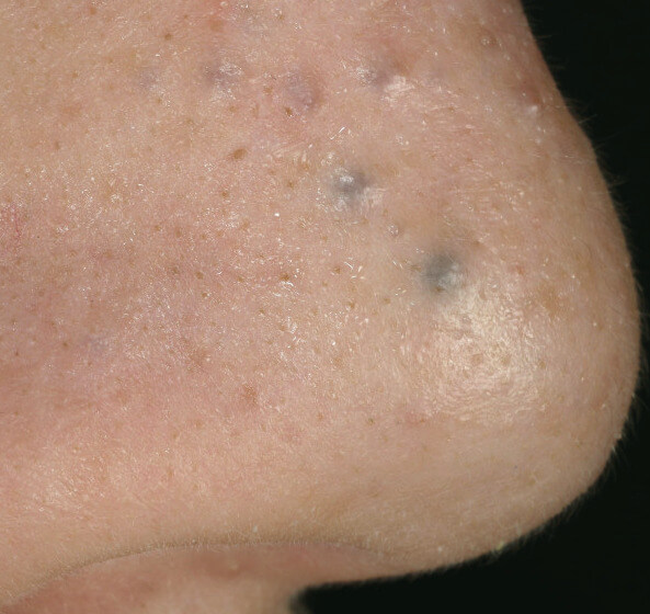 derm04_original.jpg