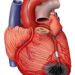 Kardiale Segmentierung Doccheck Flexikon