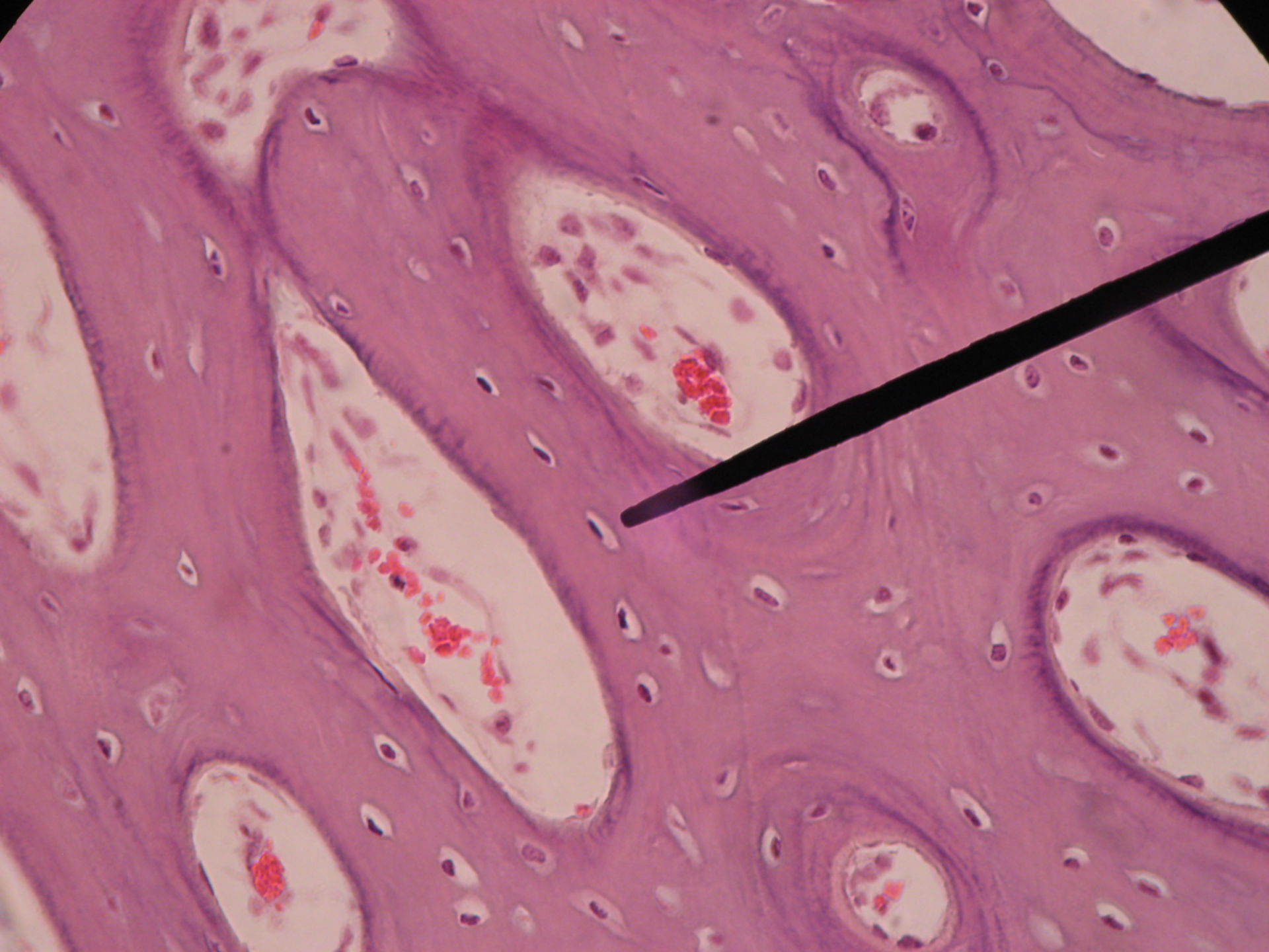 Rotes Knochenmark eines Schweinefetus (8) - Osteoprogenitorzellen   Osteoblasten