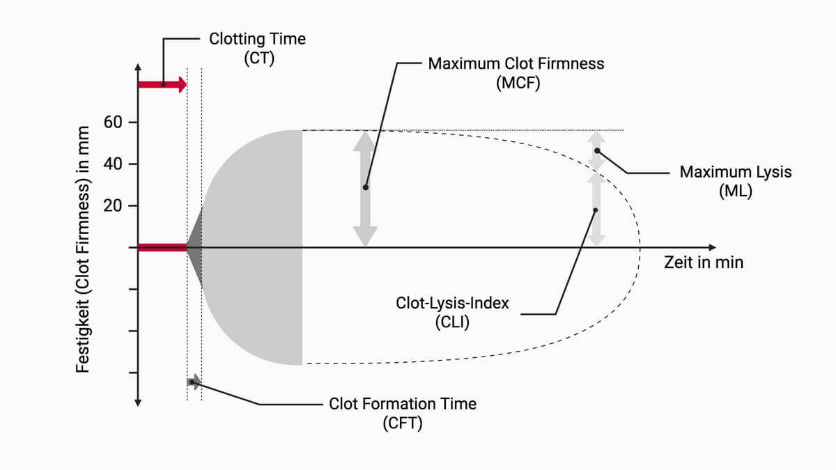 Rotationsthrombelastometrie (ROTEM®)