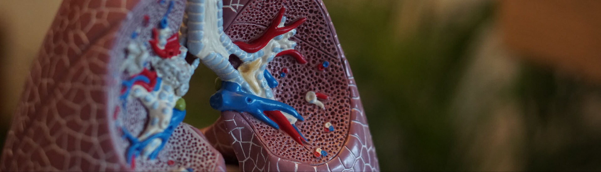 Bronchialkarzinom Teste dein Wissen! DocCheck