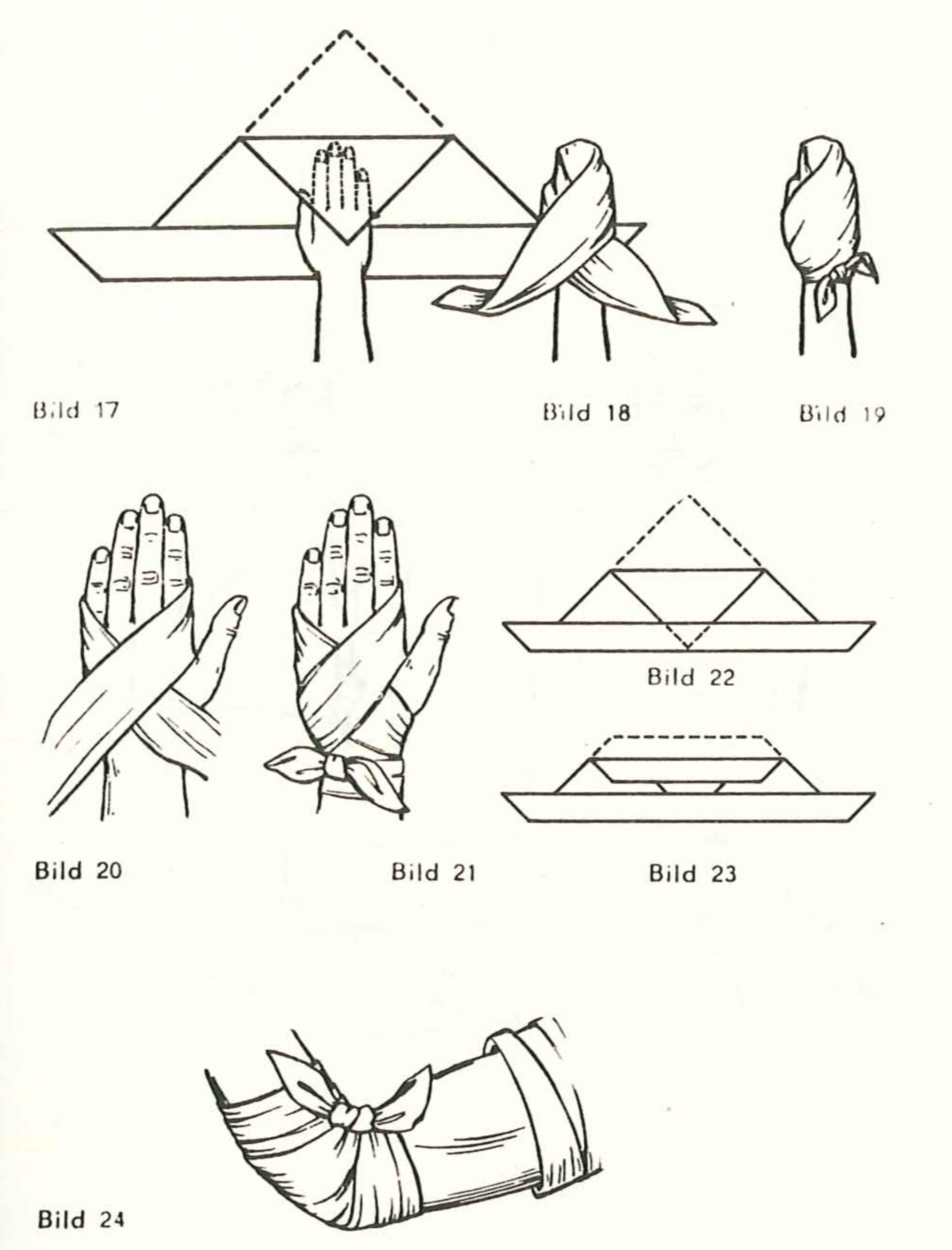Emergency dressing of arm and hands