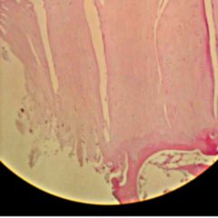 Arthrose DocCheck Flexikon