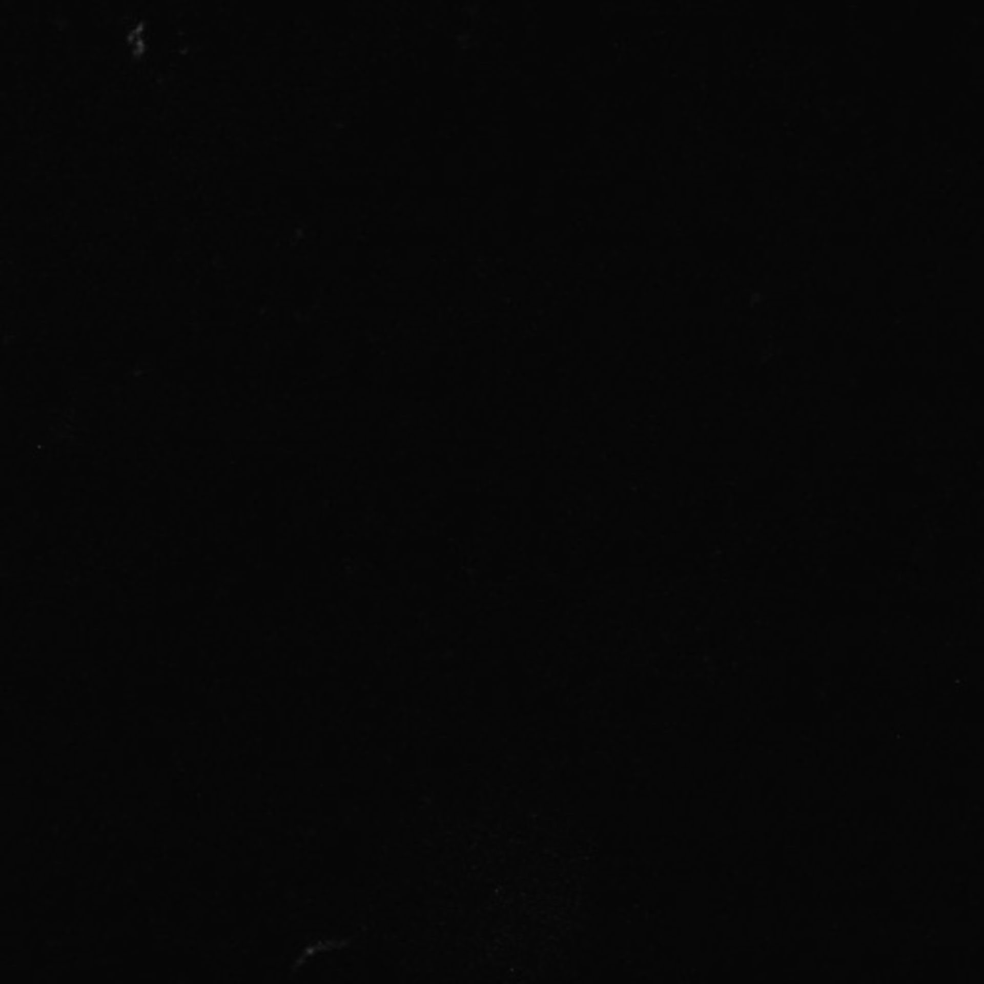 Xenopus laevis (Axon) - CIL:37020