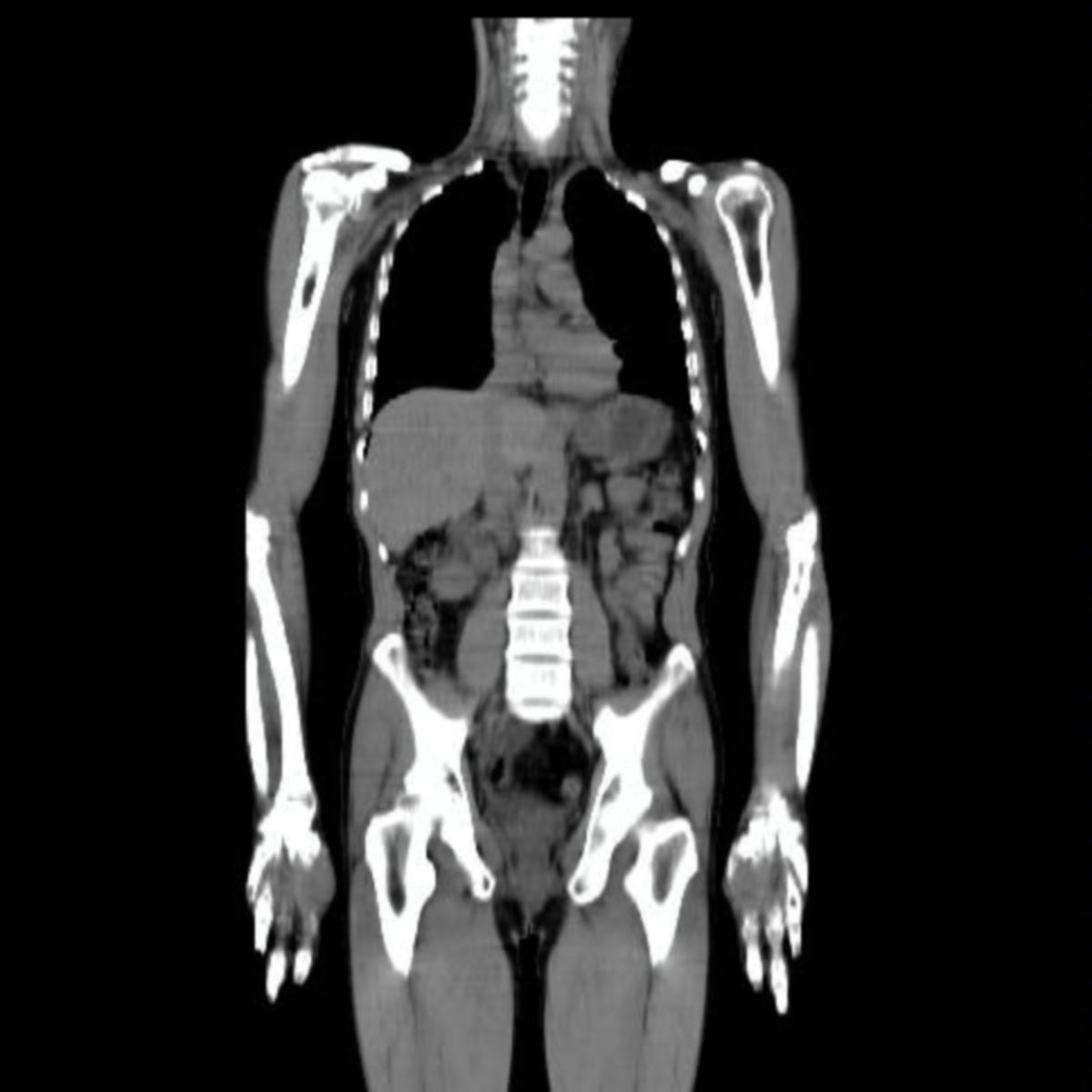 Ct Basic Body Scan CT scan - DocCheck