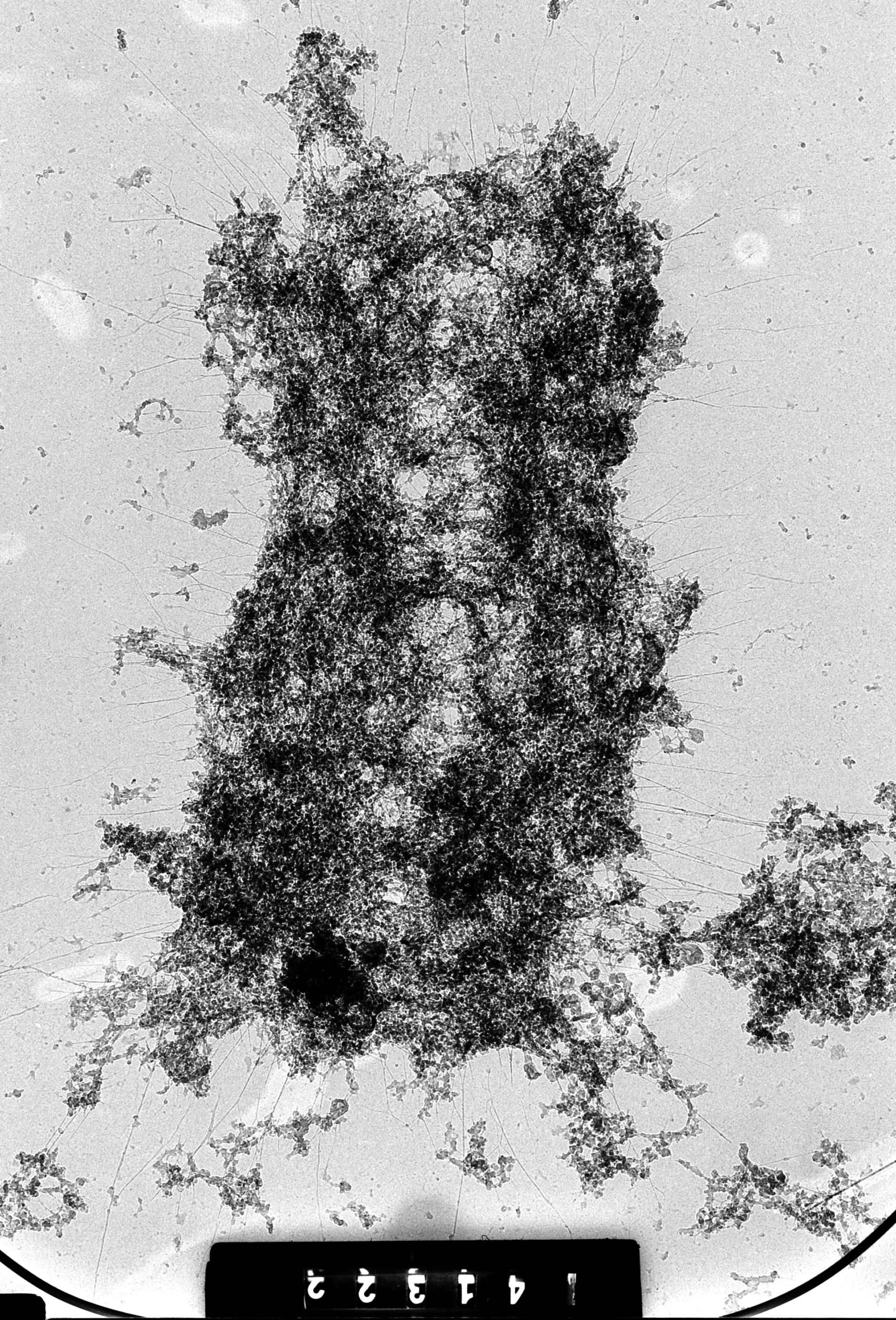 Homo sapiens (Condensed chromosome) - CIL:35374