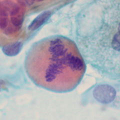 Mitose - DocCheck Flexikon