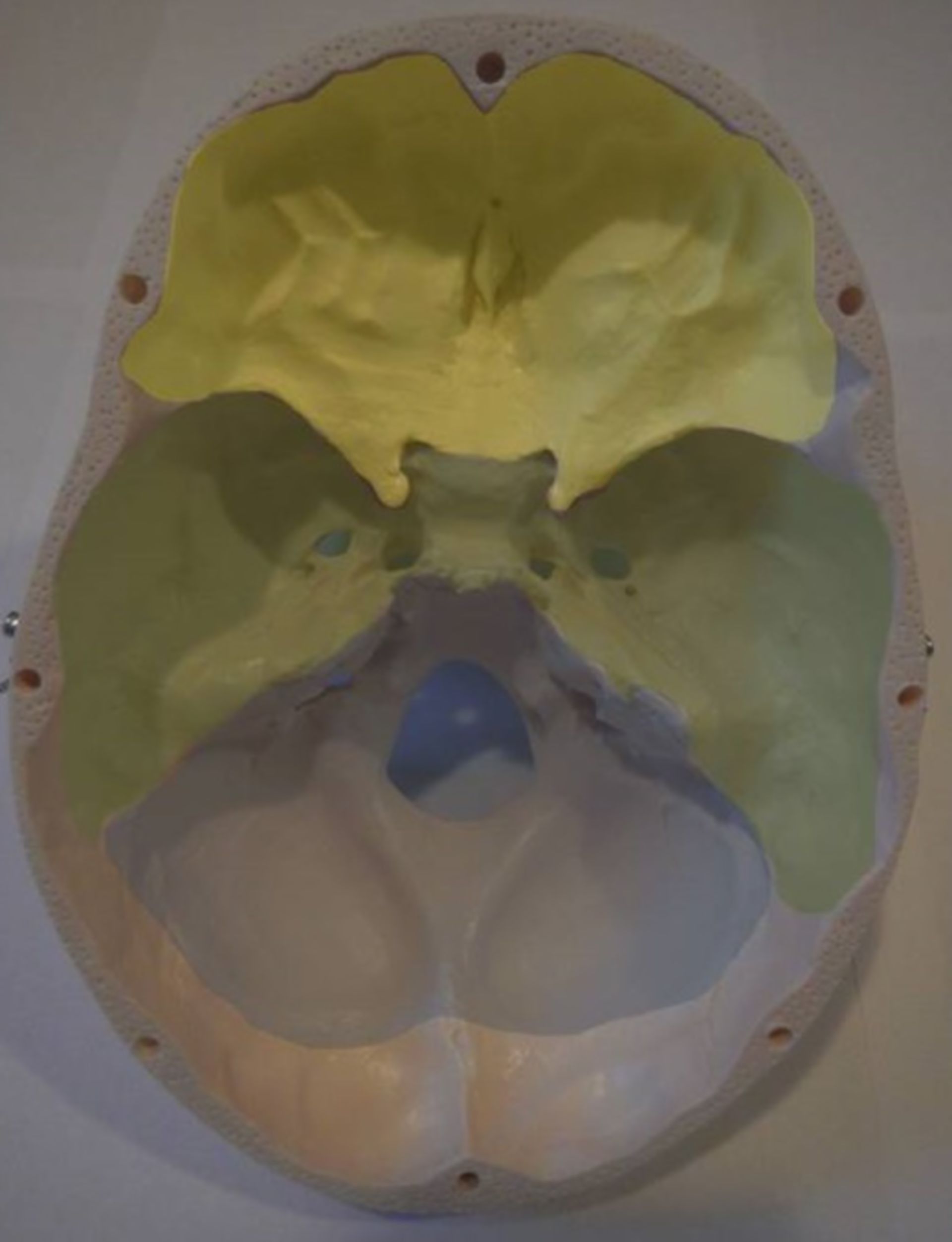 Basis cranii interna - Base of the skull from inside