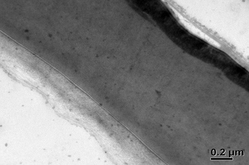 Ei einer Asiatischen Tigermücke im Anschnitt mit Eihhaut (Serosa) und Eihülle (Chorion) v.l.n.r. Deutlich erkennbar ist rechts die dunkel erscheinende Wachsschicht des inneren Chorions. © Aljoscha Kress