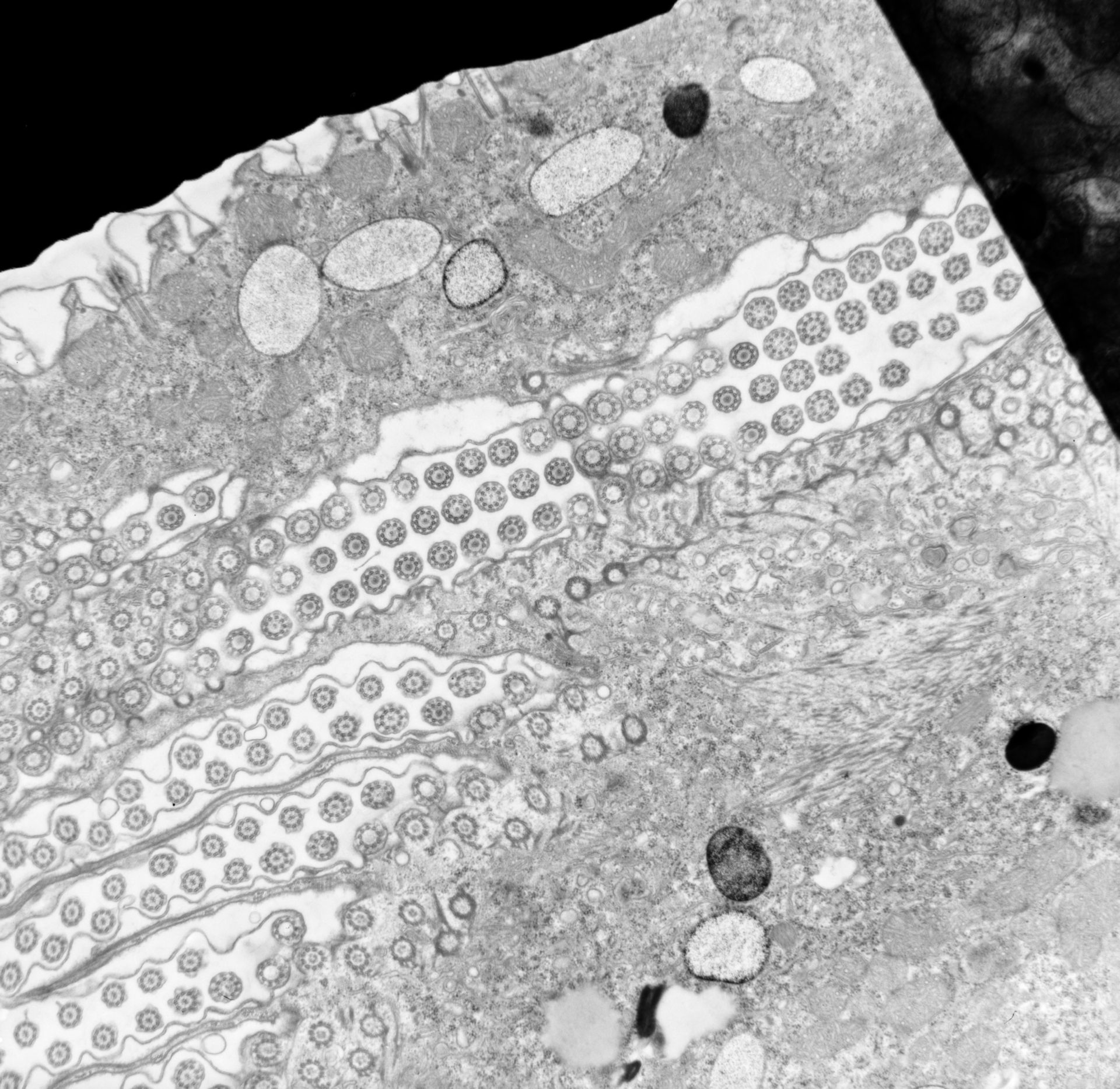 Conchophthirus curtus (Cilium axoneme) - CIL:39245