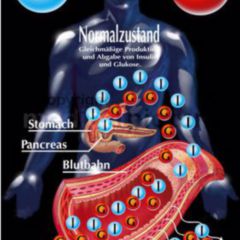 Necrobiosis jelentése | necrobiosis jelentése magyarul a dictzone angol-magyar szótárban