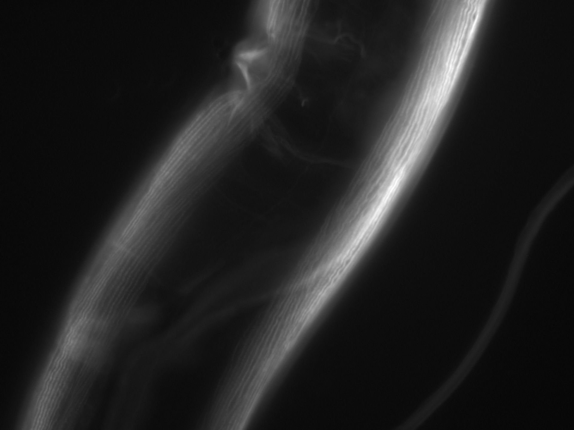 Caenorhabditis elegans (Actin filament) - CIL:1063