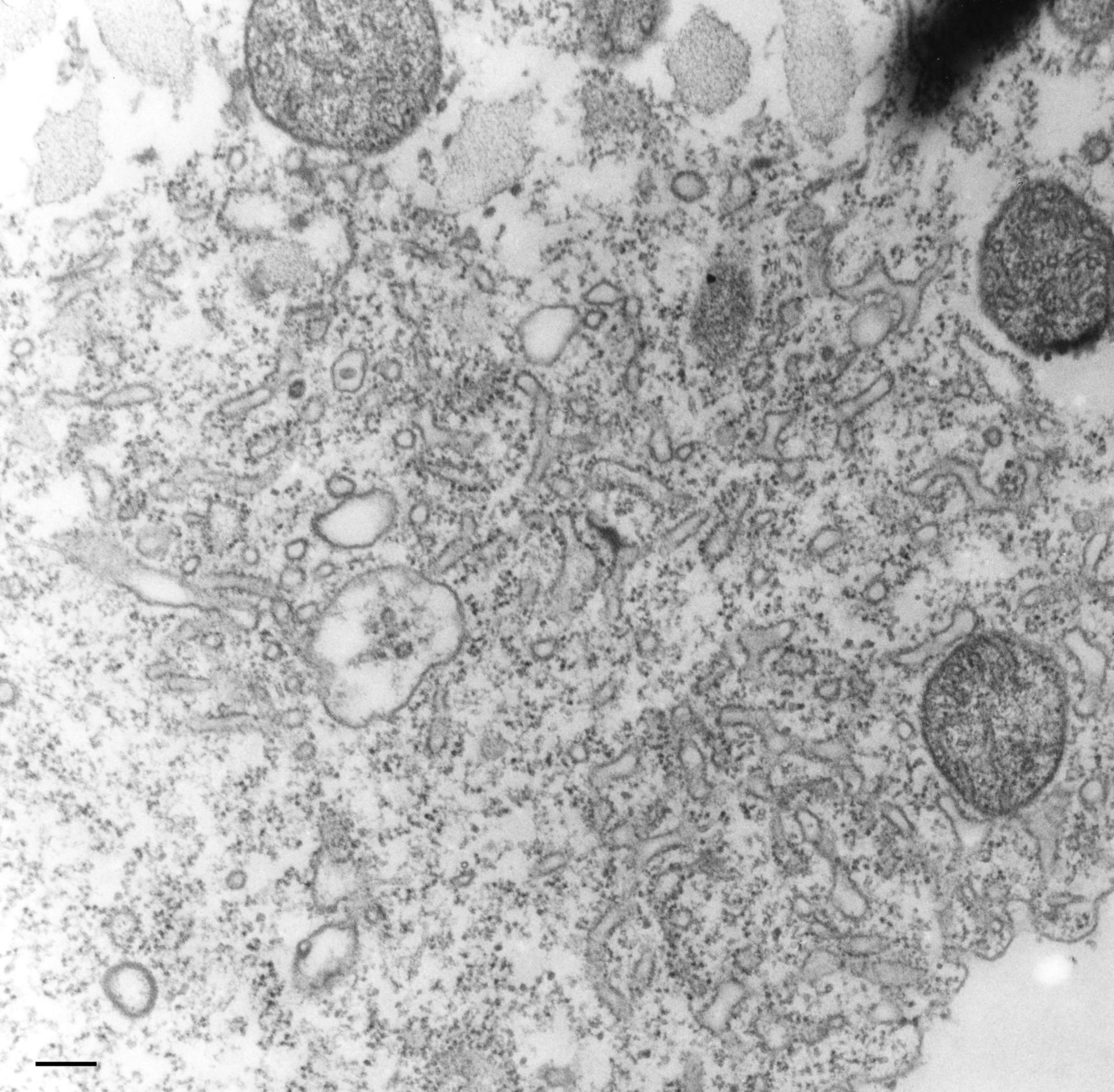 Tetrahymena pyriformis (Intrinsic to contractile vacuolar membrane) - CIL:36235