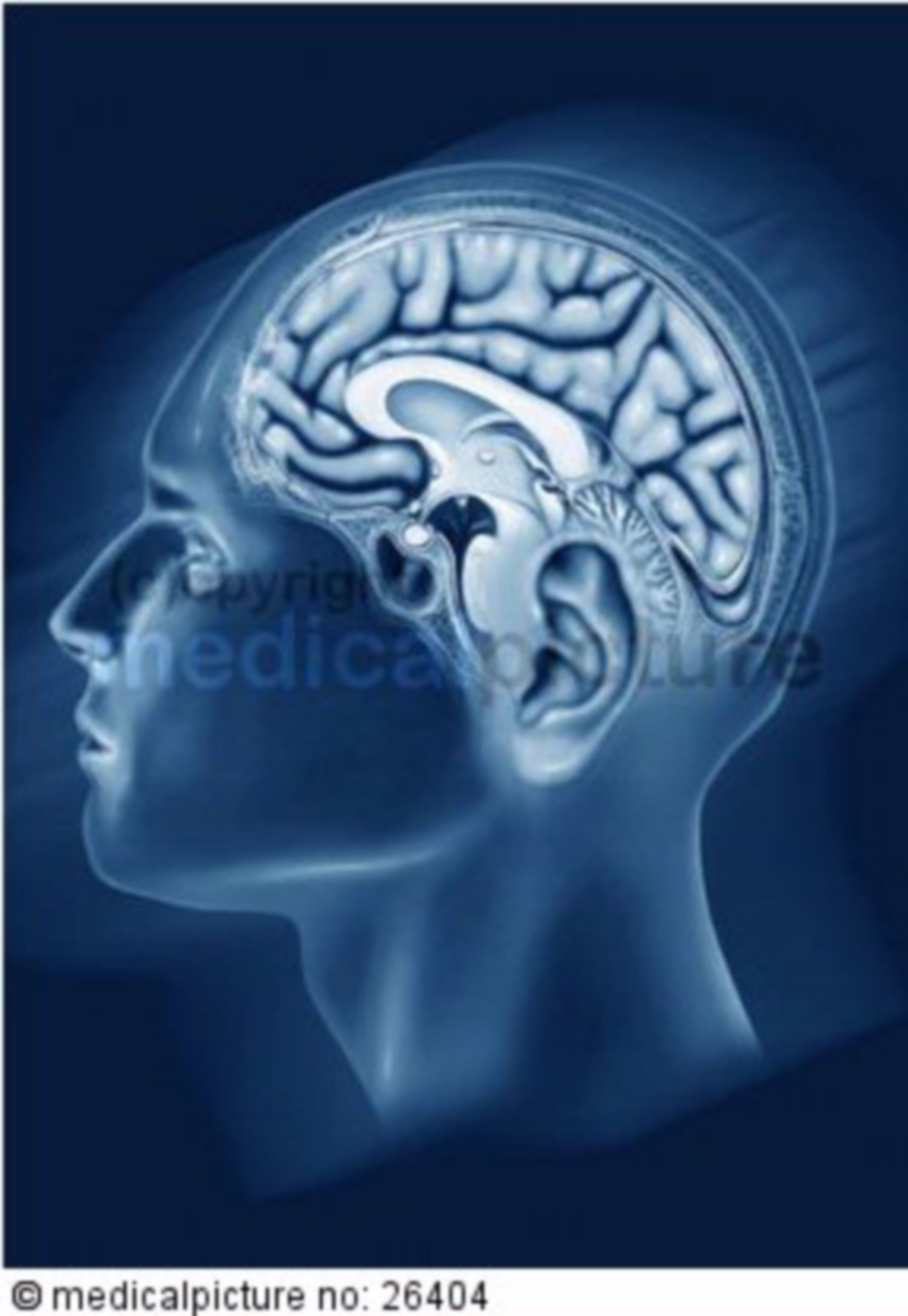  Gehirn in einfarbigem Kopf, brain in single-colored head 
