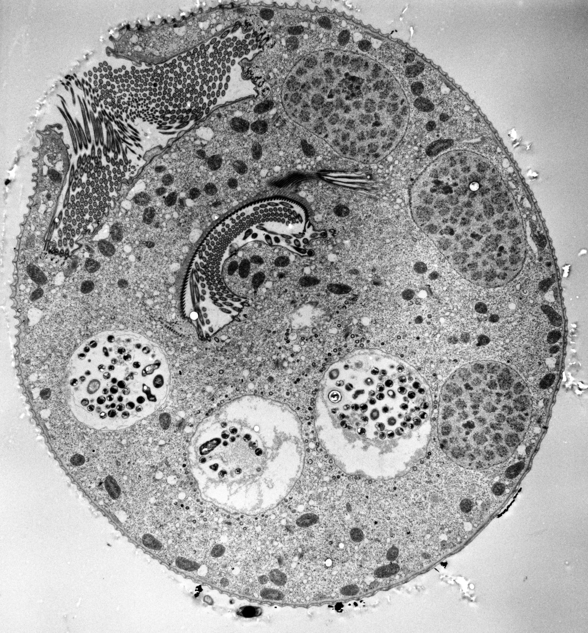 Vorticella convallaria (Oral apparatus) - CIL:39408