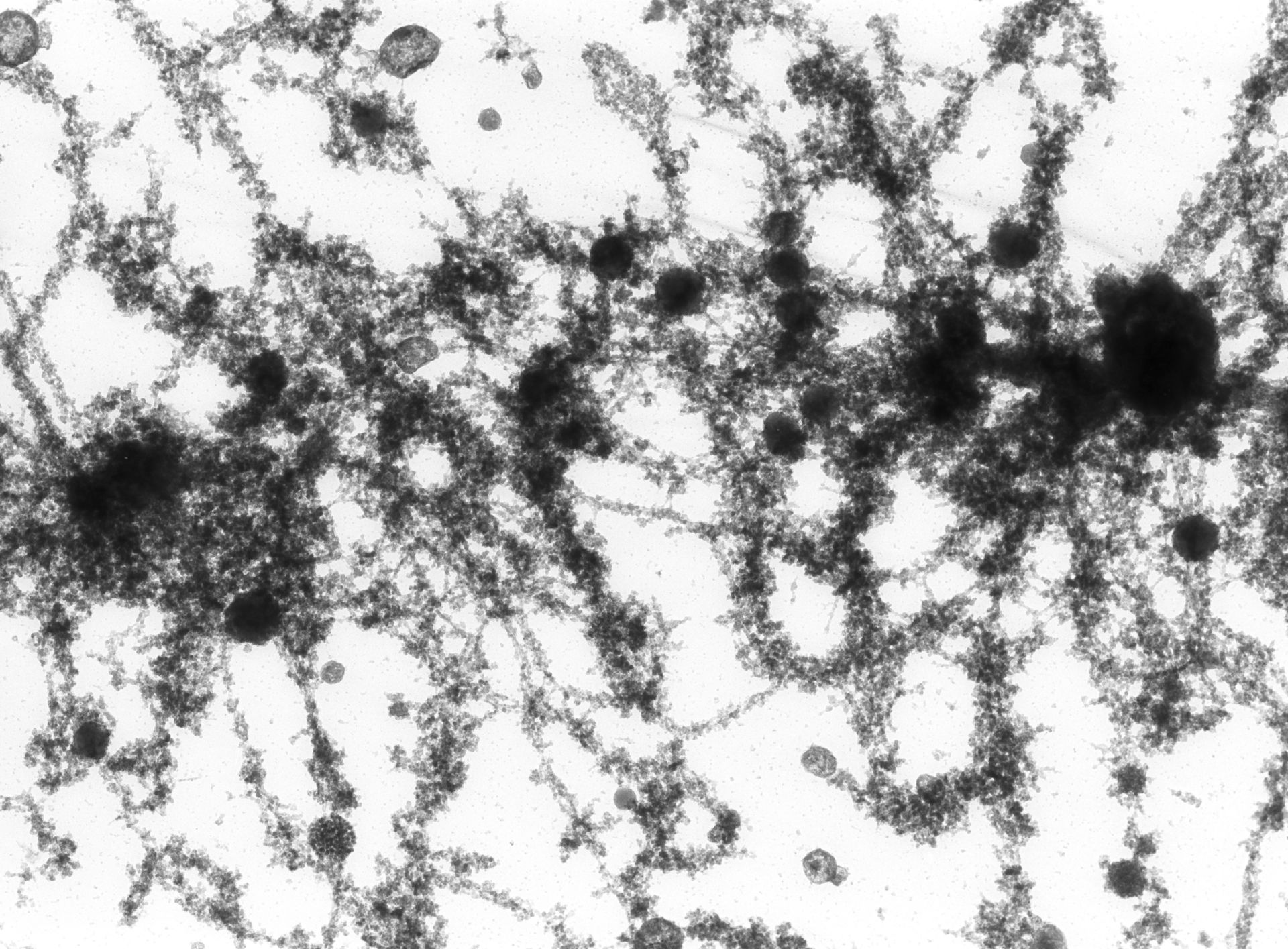 Notophthalmus viridescens (Lampbrush chromosomes) - CIL:10718