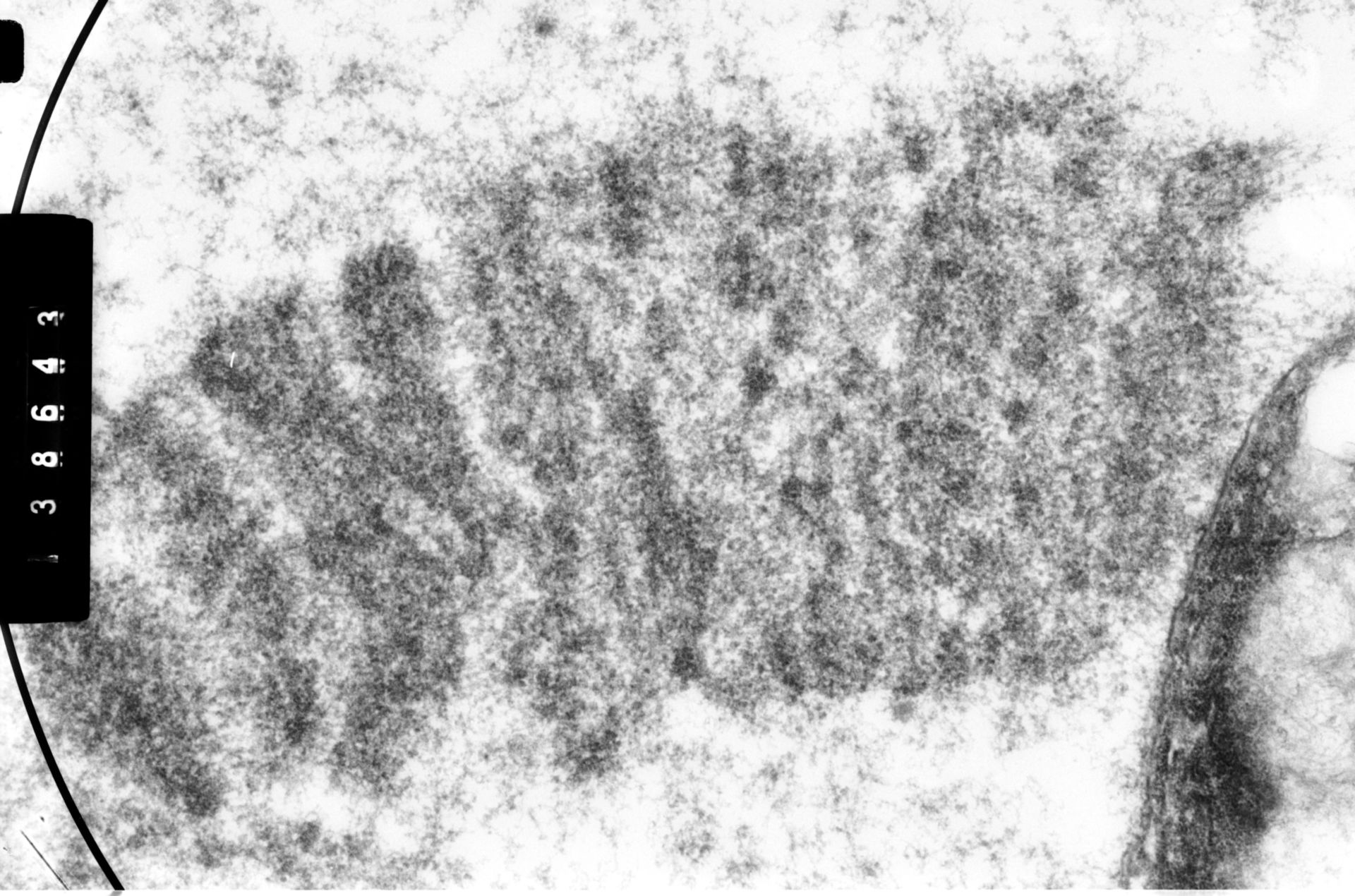 Drosophila melanocephala (Polytene chromosome) - CIL:35387