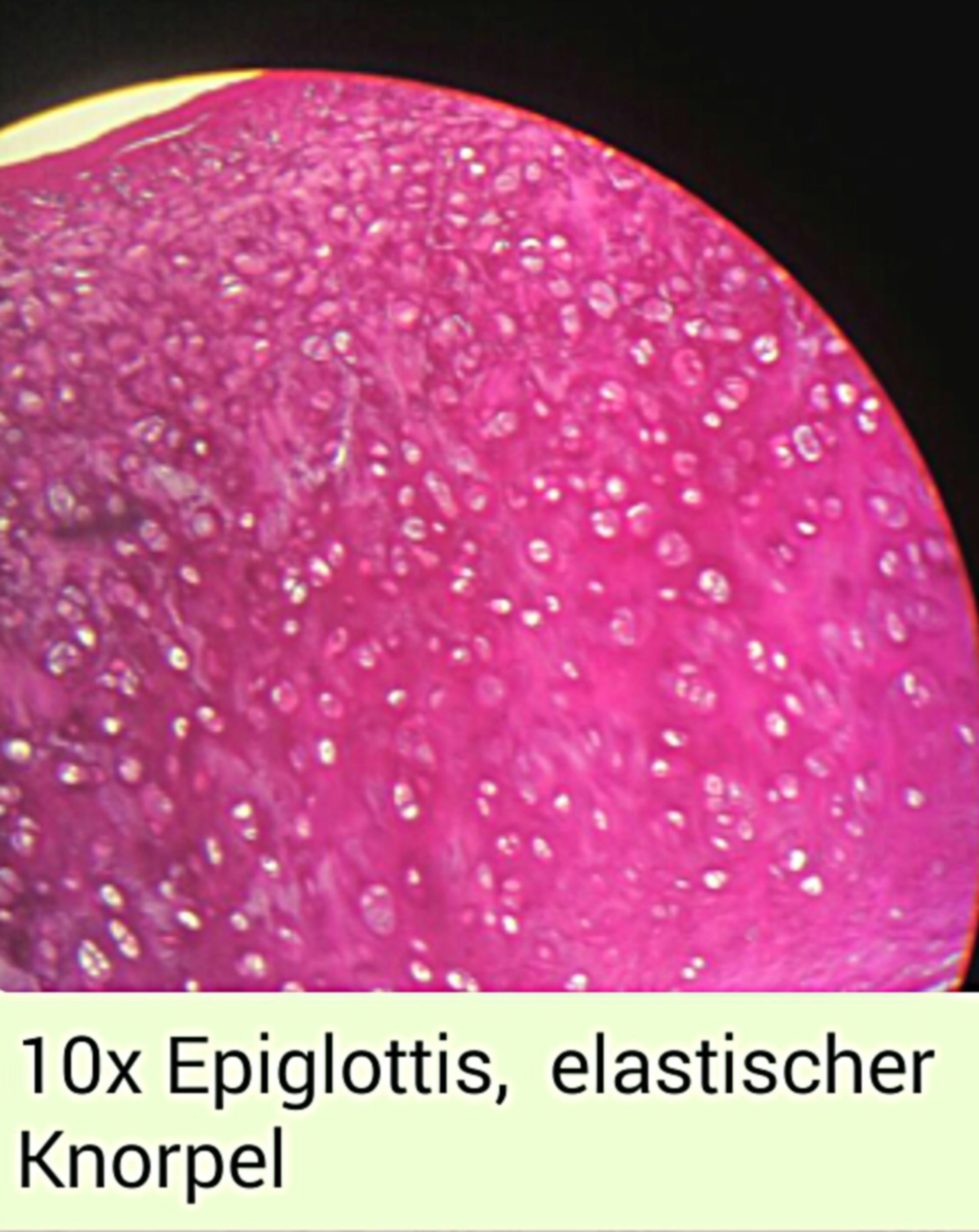 Epiglottis2