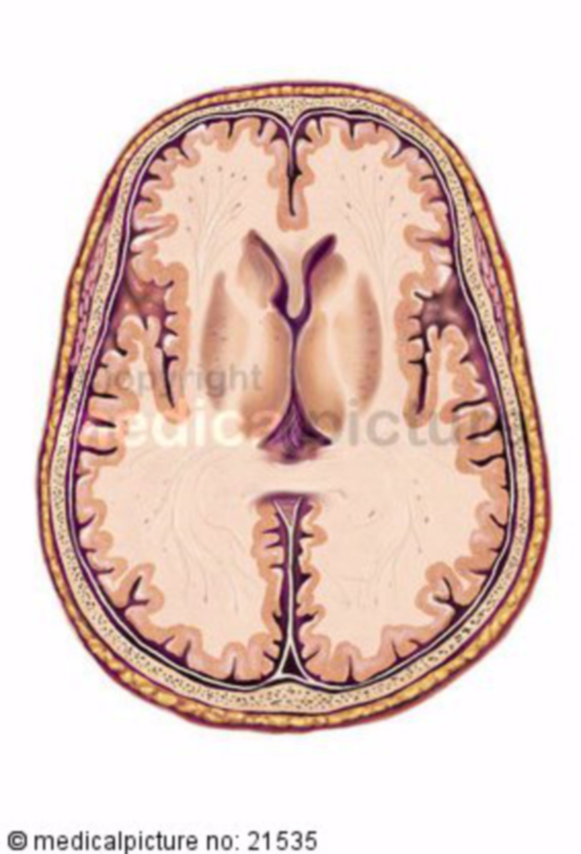  Horizontalschnitt des Gehirns auf Höhe der Basalganglien 

