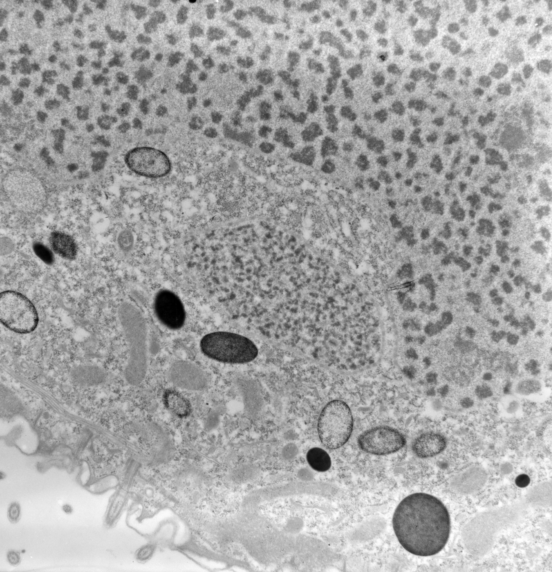 Conchophthirus curtus (Cytoplasm) - CIL:39242