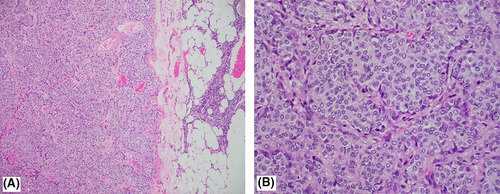 ccr34435-fig-0003-m_original.jpg