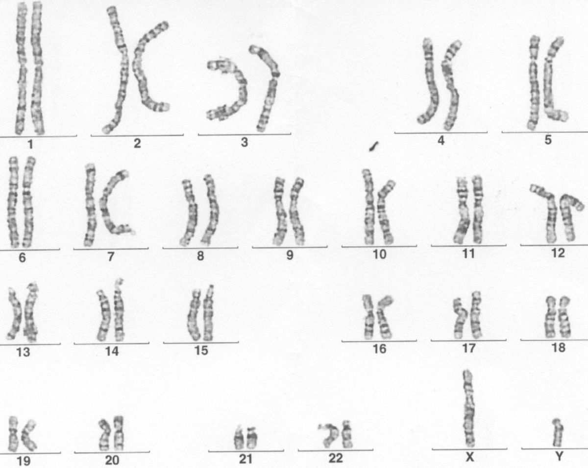 Genom-Scan (Karyogramm)