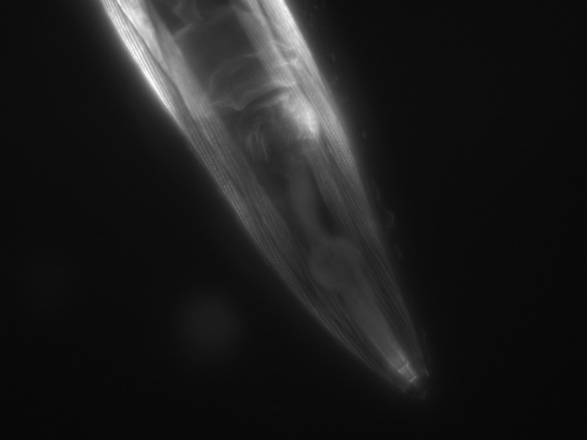 Caenorhabditis elegans (Actin filament) - CIL:1068