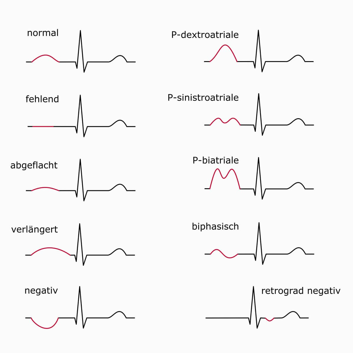 Schematische Darstellung von P-Wellen-Konfigurationen
