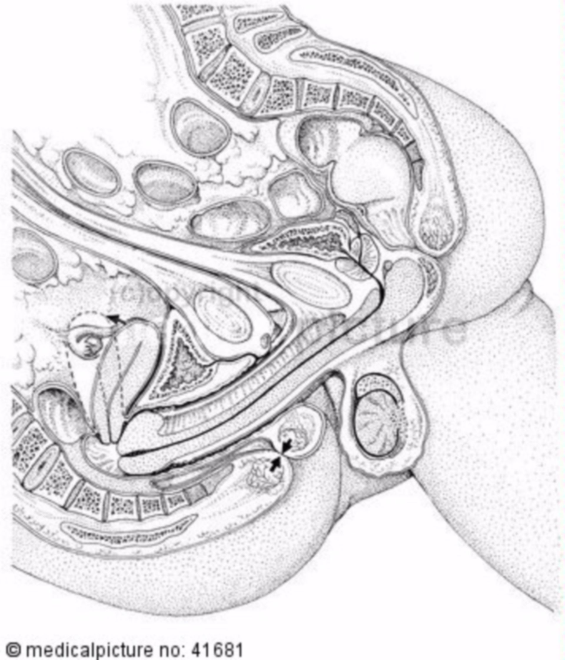 Sagittal section during intercourse 3