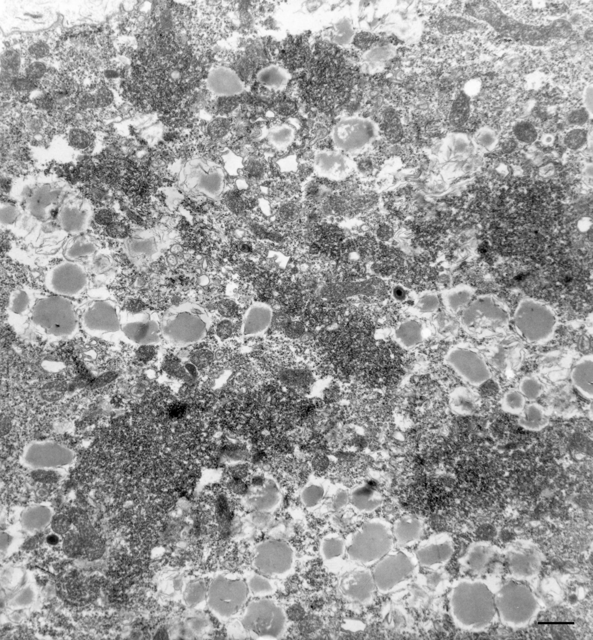 Paramecium multimicronucleatum (Golgi stack) - CIL:36644