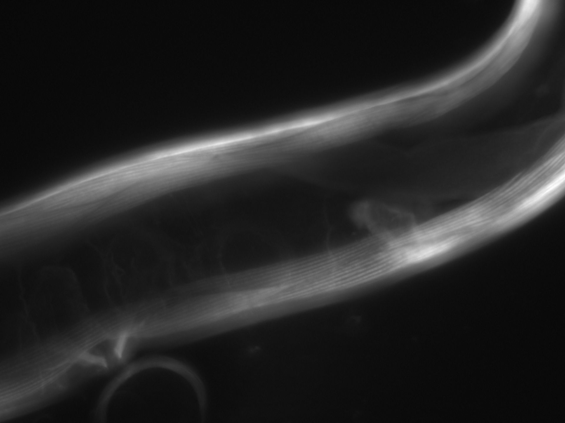 Caenorhabditis elegans (Actin filament) - CIL:1062