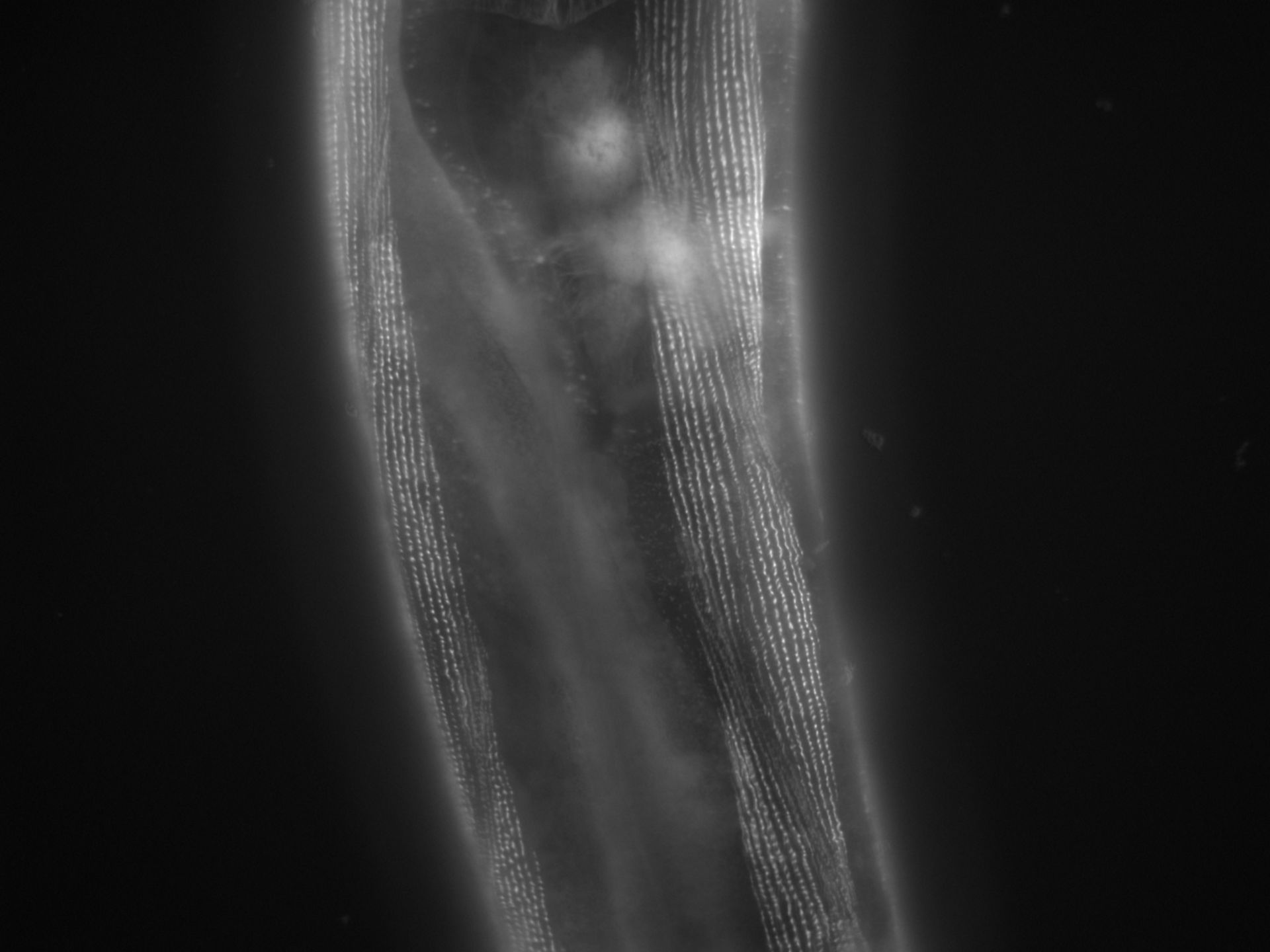 Caenorhabditis elegans (Actin filament) - CIL:1138