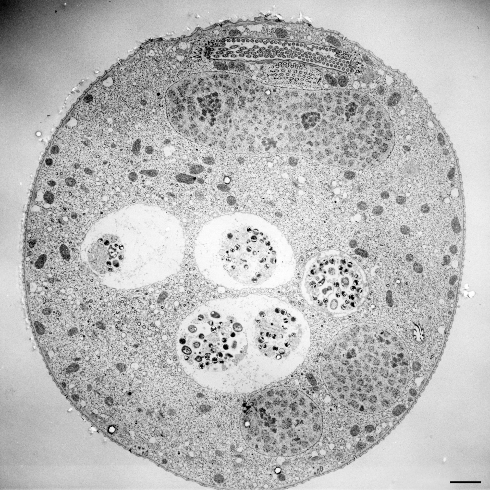 Vorticella convallaria - CIL:36248