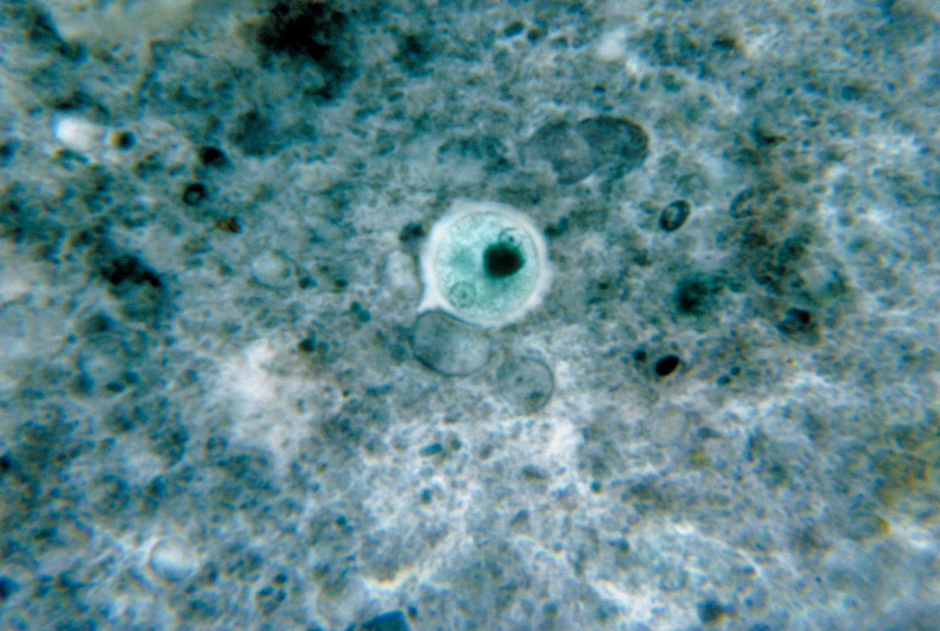 Cisti Entamoeba histolytica