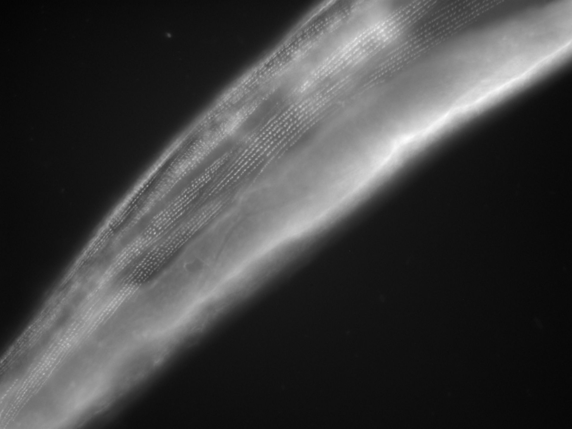 Caenorhabditis elegans (Actin filament) - CIL:1264