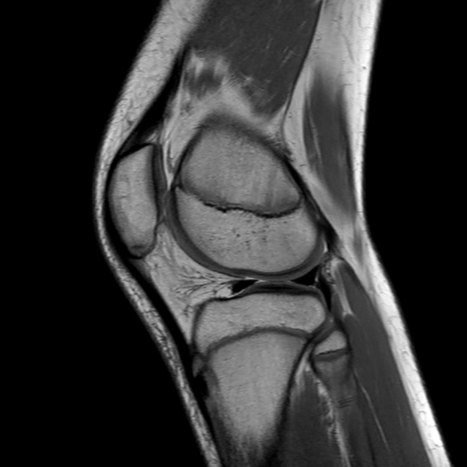 Risonanza Magnetica Del Ginocchio Doccheck