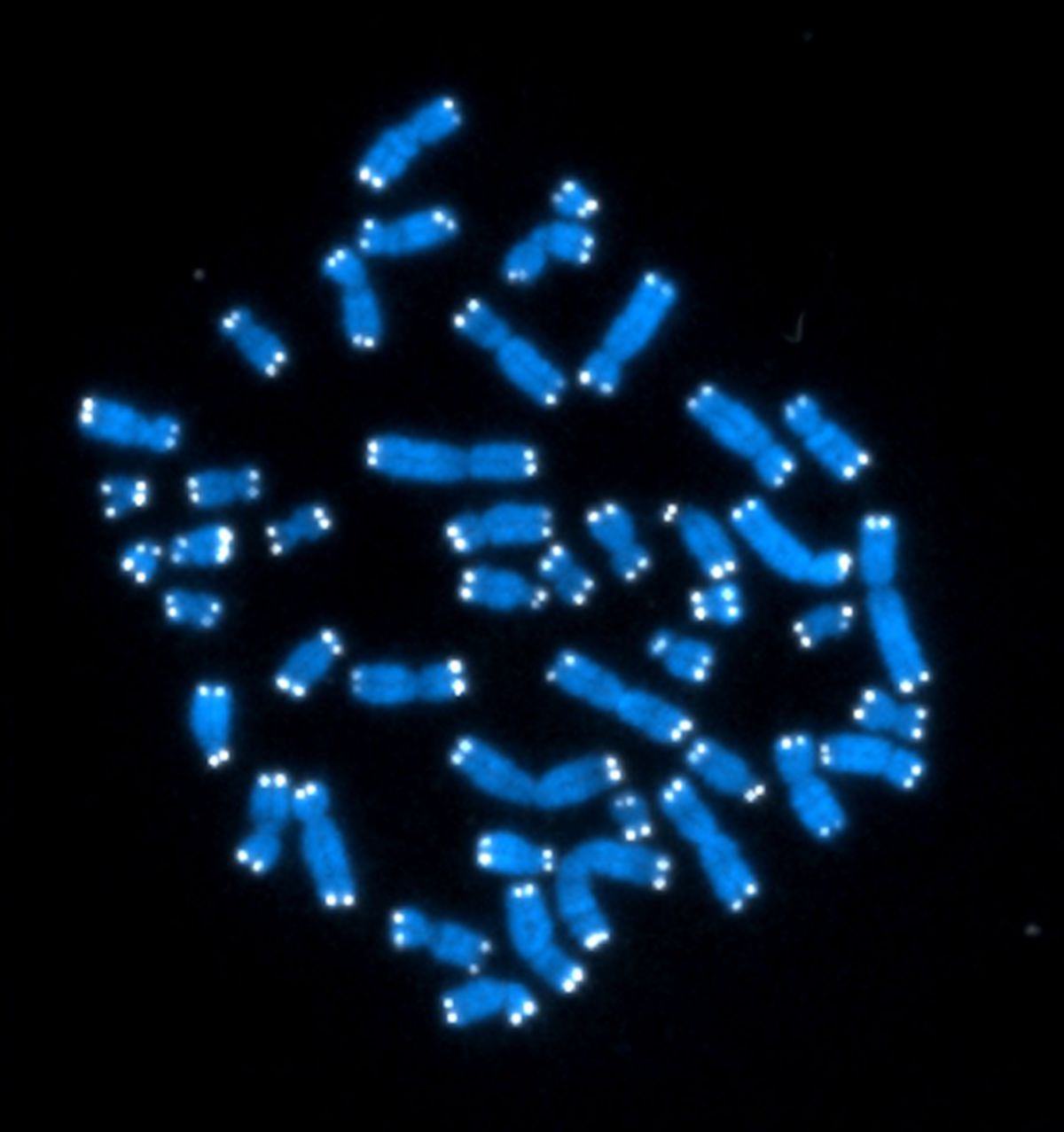 Homo sapiens (Chromosome, telomeric region) - CIL:228