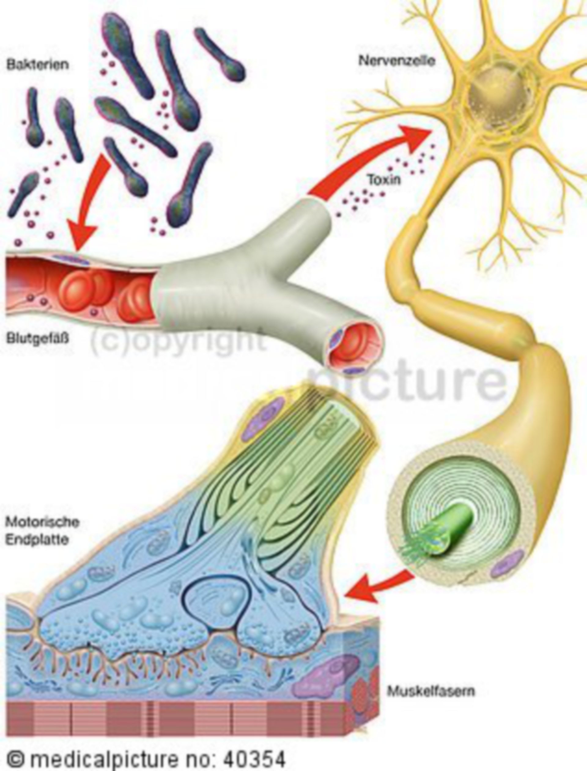 Clostridium tetani, tetanus: Path of infection
