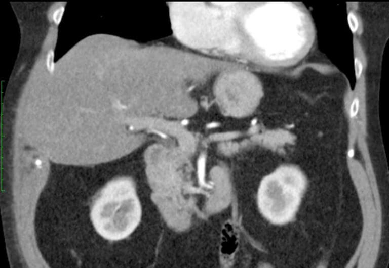 LeberHernie DocCheck