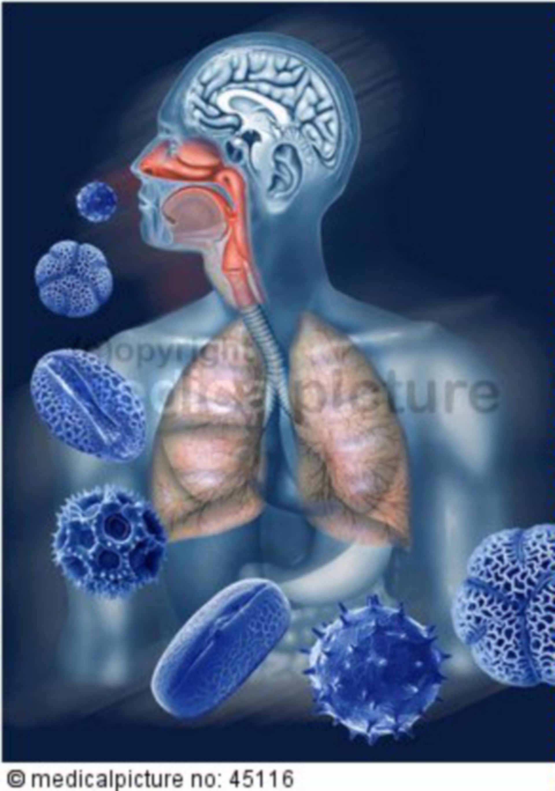 Allergic Lung Diseases
