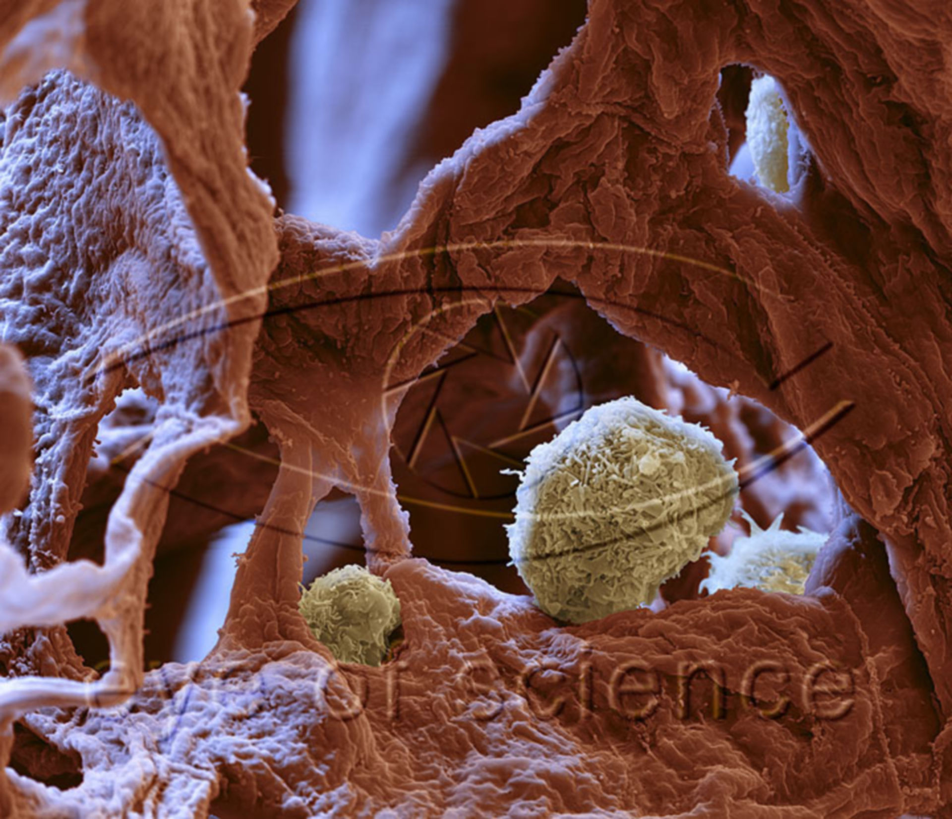 Alveolarmacrophagen, Lunge 4500x