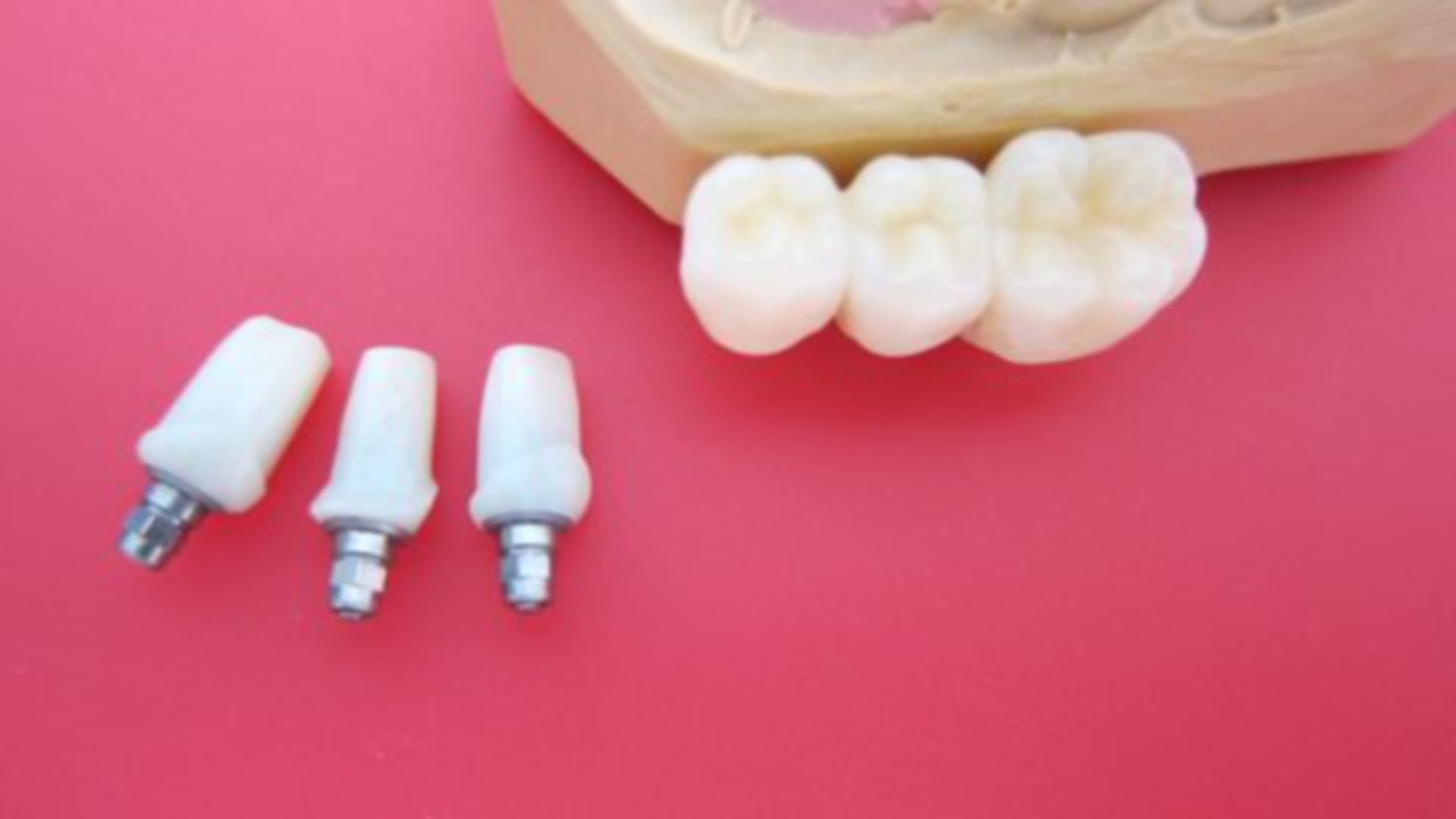 Solid zircon oxide implants