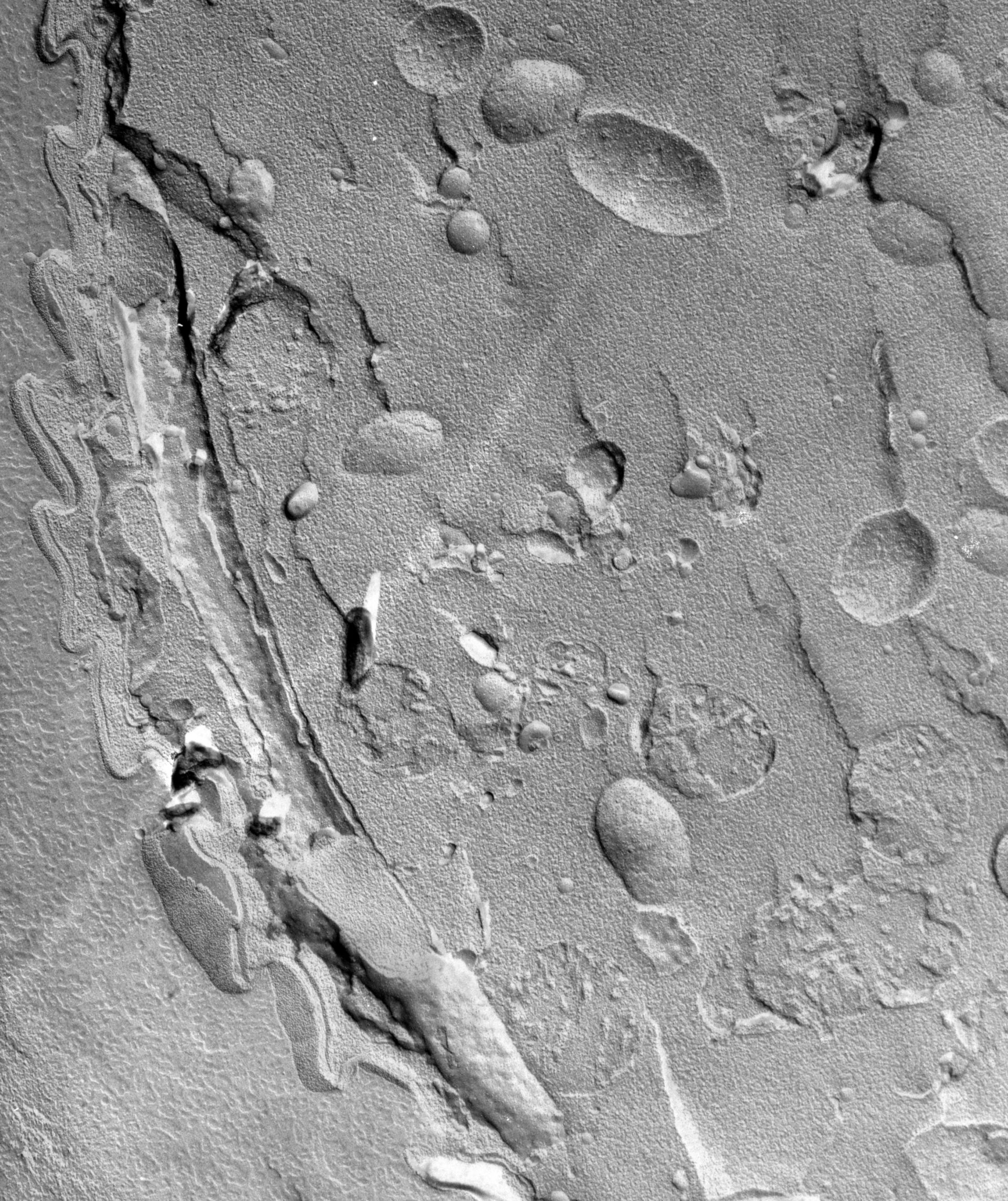 Vorticella microstoma (Cytoplasm) - CIL:39503