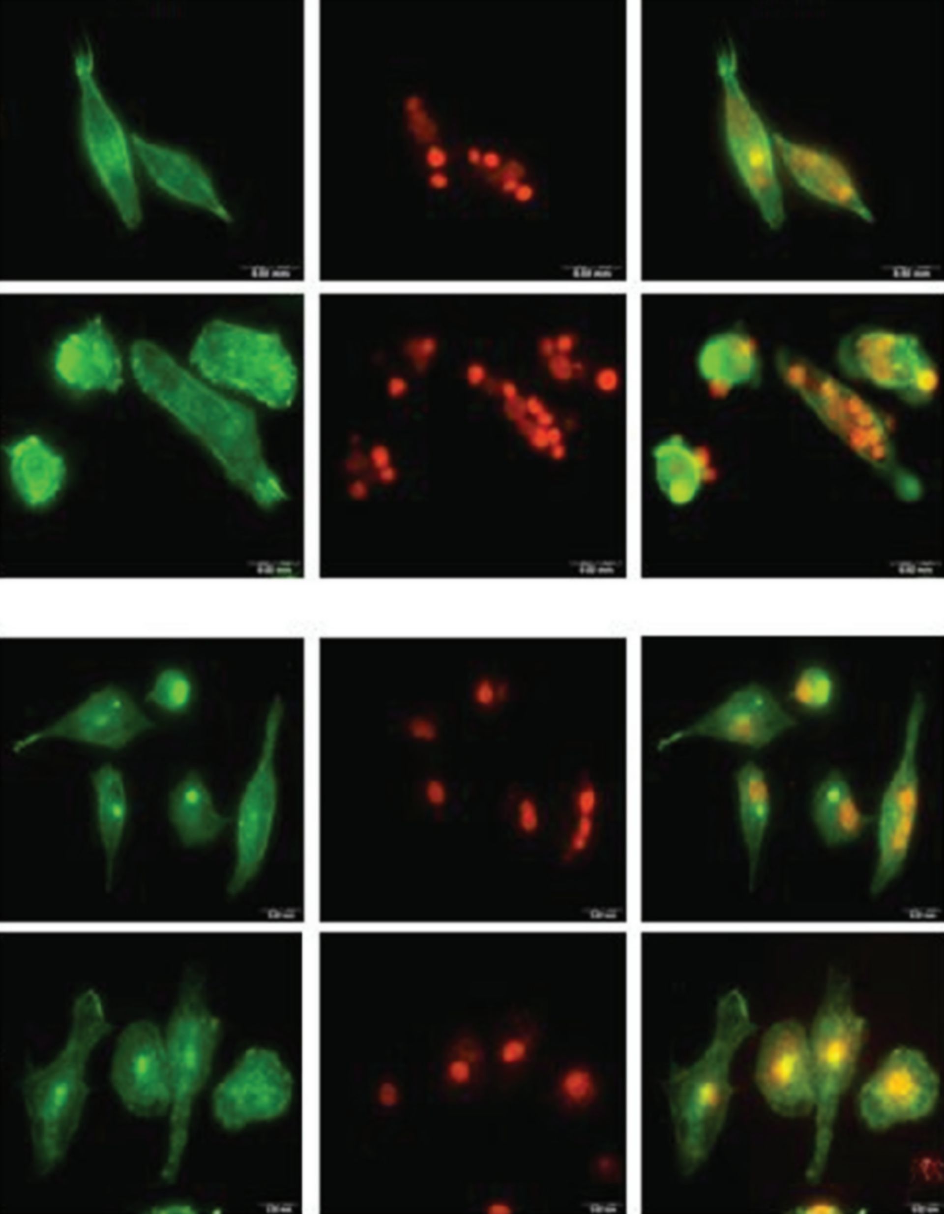 Phagozytäre Fähigkeiten von B-1 Zellen der Maus