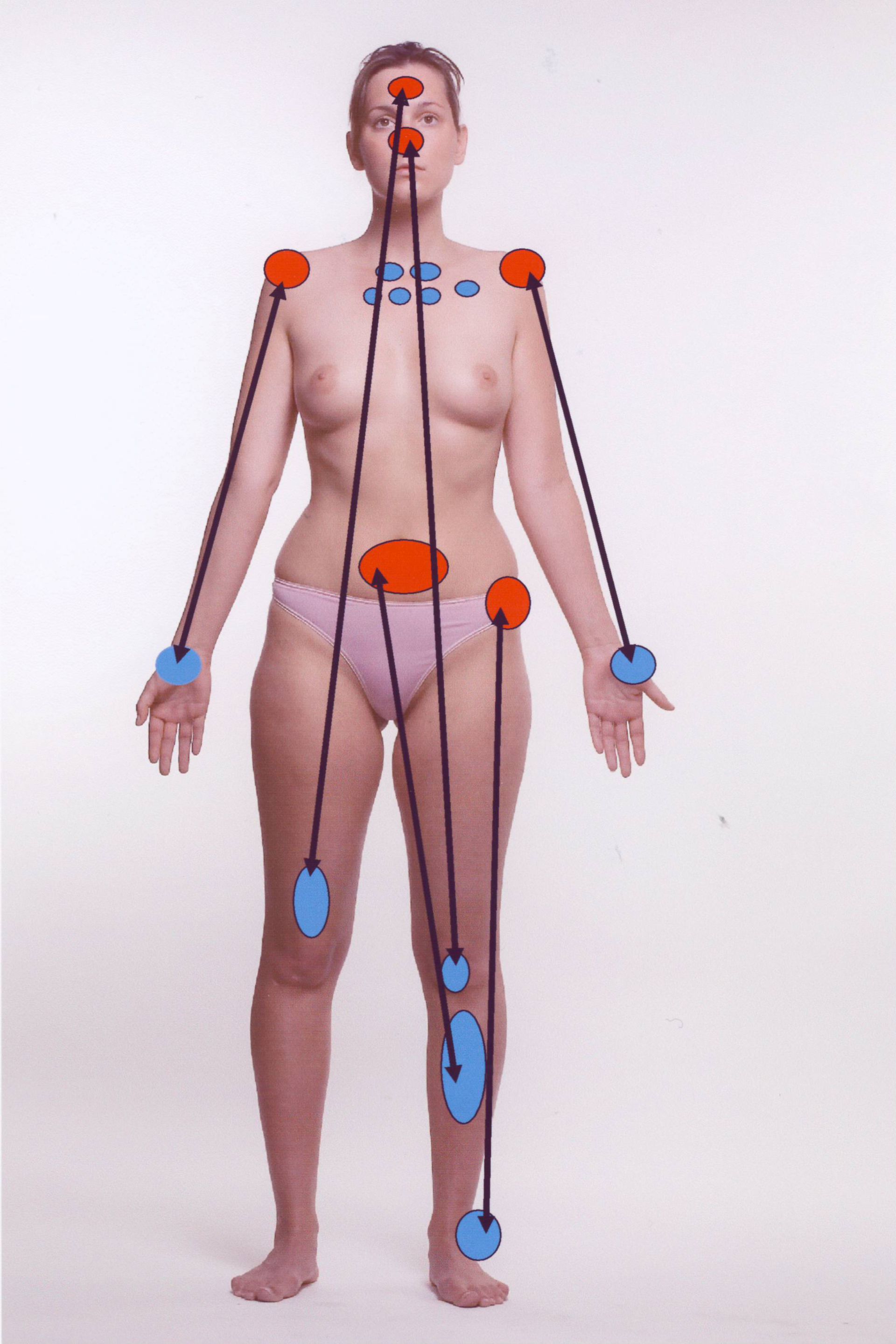 Pain managment after the Ibis-scheme, ventral 2