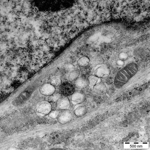 Elektronenmikroskopische Aufnahme einer Coronavirus-infizierten Zelle mit zahlreichen Membranvesikeln, an denen sich die Coronaviren vermehren. © Volker Thiel, IVI, Universität Bern.