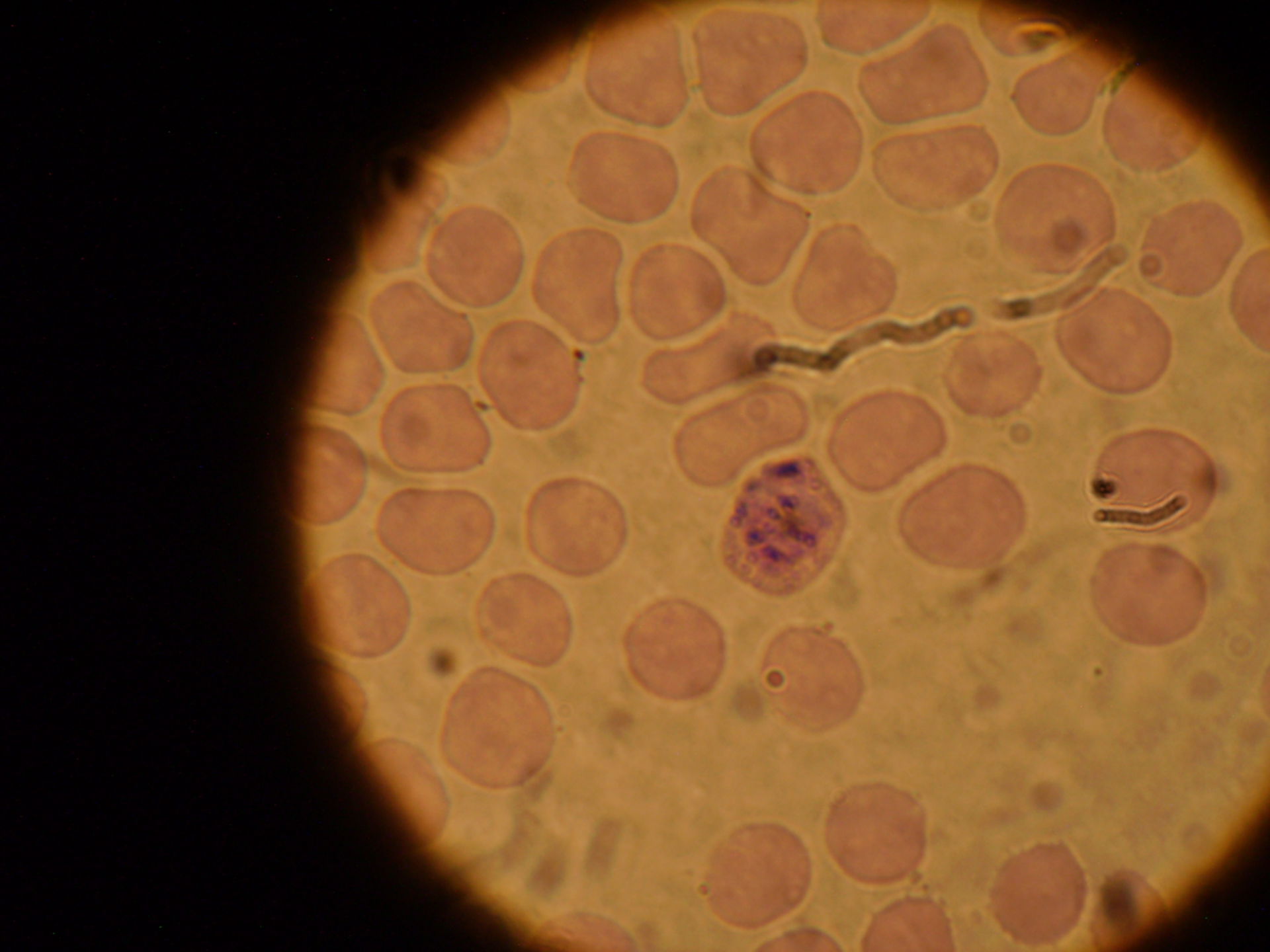 Plasmodium ovale schizont c